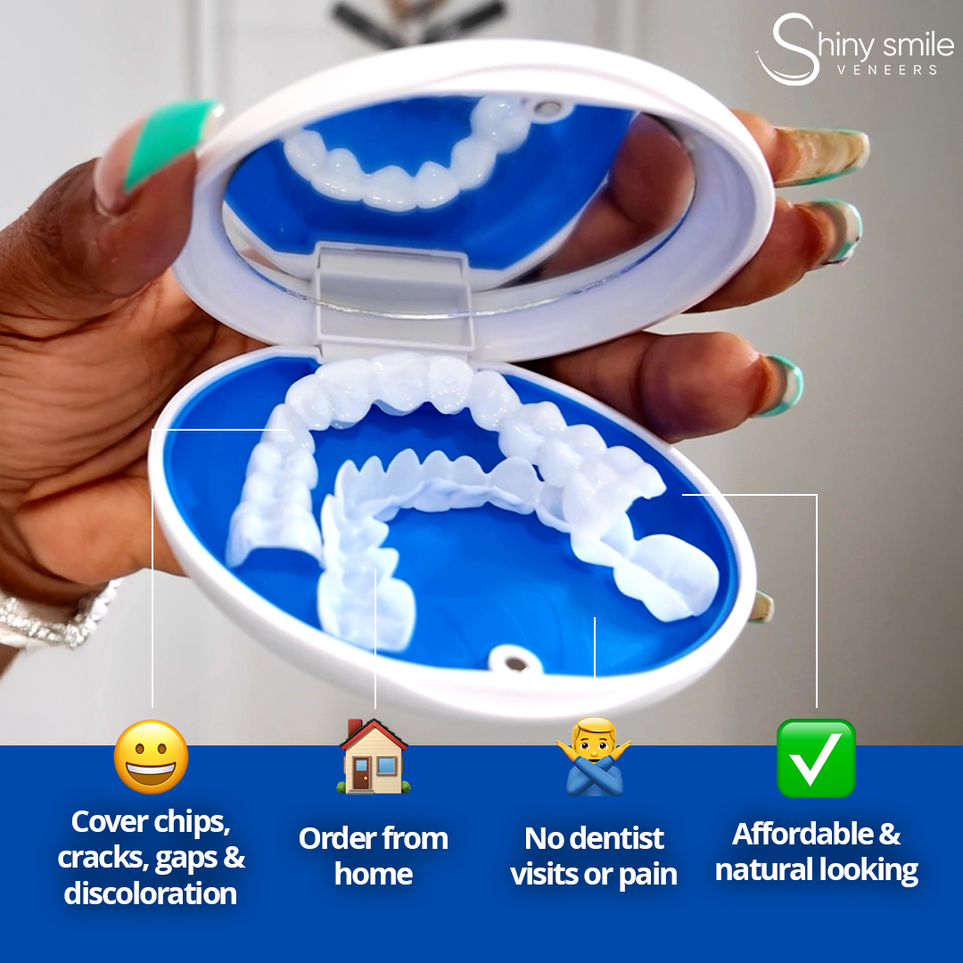 Shiny Smile Veneers product in its case